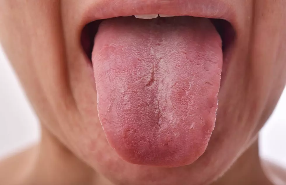 Michigan Man Sets Guinness World Record With His Tongue